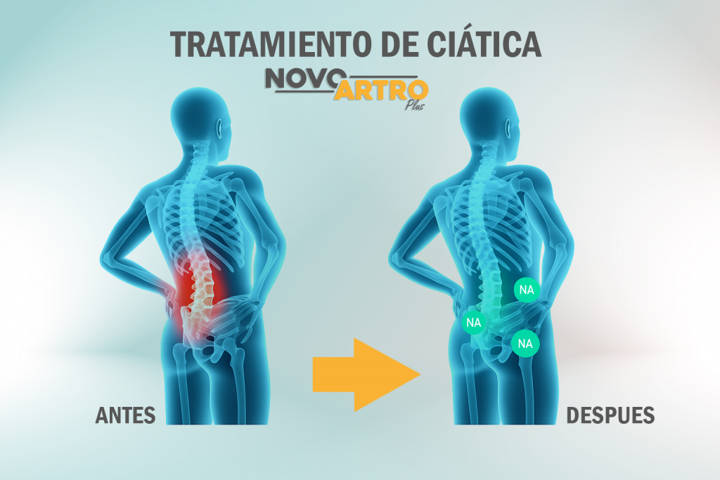 CIATICA PORTADA